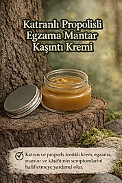 Propolisli Katranli Egzama, Mantar kremi