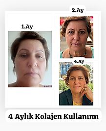 5 in Beauty  Elixir kolajen  2Lİ ALIMLARDA INDİRİMLİ